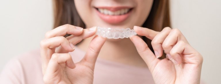 Invisalign-Zahnschiene: Kosten und Finanzierungsmöglichkeiten